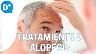 Los mejores tratamientos para combatir la alopecia [upl. by Kent]