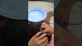 lice Removal part 12shots [upl. by Alby]