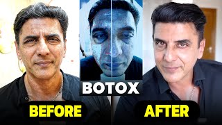 எப்படி இருந்த நான் இப்படி ஆகிட்டேன் 🫢 Full Face Botox Treatment  King Prithiveeraj [upl. by Leirvag439]