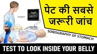 पेट की सोनोग्राफी  Abdominal Ultrasound  Understand Sonography Test  DrEducation [upl. by Alracal613]