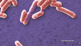 CarbapenemResistant Enterobacteriaceae CRE [upl. by Arella]