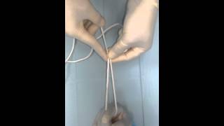 Extracorporeal Meltzer Knot [upl. by Blanc]