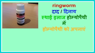 homoeopathic treatement for ring worm दाद  दिनाय का होम्योपैथिक इलाज [upl. by Ormand775]