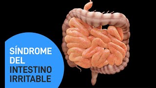 Síndrome de intestino irritable [upl. by Eizzo]