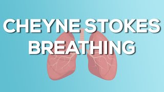 Cheyne Stokes Breathing  Causes Demonstration Treatment [upl. by Daniel]