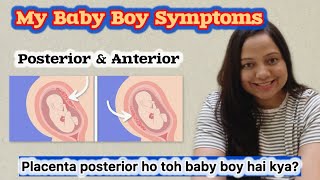 My Baby Boy Symptoms in pregnancy  Placenta Position se pata chalta hai baby ka gender [upl. by Enilecram534]