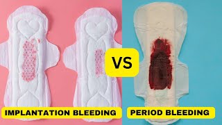 lmplantation bleeding vs periodimplantation bleedingimplantation bleeding or period [upl. by Haughay]