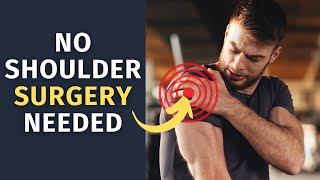 How to TREAT a Rotator Cuff Injury WITHOUT Surgery [upl. by Keynes962]