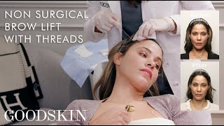 NonSurgical Brow Lift with Threads — Inside The Treatment Room  GOODSKIN [upl. by Pinkham]