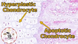 Epiphyseal Growth Plate Histology  Time to Zone Out [upl. by Lenehc]