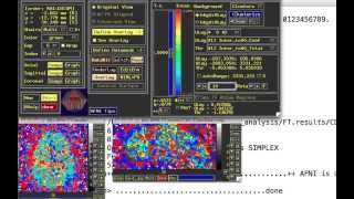 PsychoPhysiological Interactions or PPI aka ContextDependent Correlations [upl. by Gyasi]