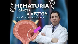 SANGRE EN LA ORINA 😱  CUIDADO APRENDAMOS DEL CÁNCER DE VEJIGA✅ [upl. by Eseekram]