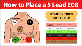 How to Place a 5 Lead ECG MNEMONIC Electrode Placement Made Easy nursing [upl. by Justus]