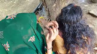 Lice Removal New Video Real Vioce For Girls Nitpickings Lice Remove Women Hand And Real Experience [upl. by Kimmel]