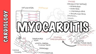 Myocarditis  causes pathophysiology investigation and treatment [upl. by Stuckey]