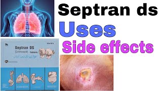 Septran ds tablets  how to use Cotrimoxazole  uses  side effects  precautions in urdi hindi [upl. by Adnalor741]