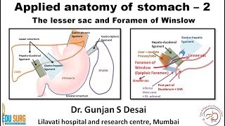 Lesser sac and foramen of Winslow  Applied anatomy of stomach part 2 [upl. by Kimberly570]