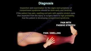 Compartment SyndromeDiagnosisPressuresFasciotomy Everything You Need To Know Dr Nabil Ebraheim [upl. by Folly425]