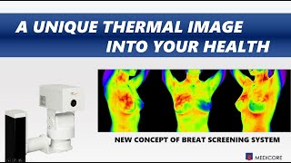 IRISXP Infrared Thermography Imaging System For Medical Use [upl. by Aicilaf]