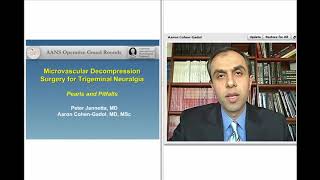 Microvascular Decompression Surgery for Trigeminal Neuralgia Preview [upl. by Hahnert]