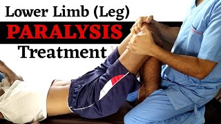 lower limb paralysis treatment  lower limb paralysis physiotherapy treatment  paralysis treatment [upl. by Wan]