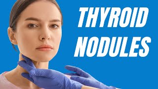 Understanding Thyroid Nodules Causes Symptoms amp Treatment Options [upl. by Barfuss73]