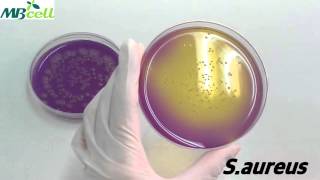 Dextrose Tryptone Agar [upl. by Eednahs263]