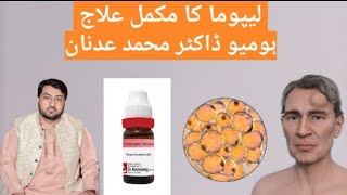 Lipoma Ka Treatment  Lipoma Ka Elaaj  Homoeo Dr Adnan [upl. by Marrissa]