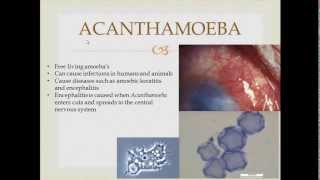 Parasitology Acanthamoeba [upl. by Evilo]