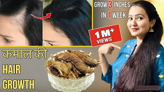 30 Days Extreme Hair Growth Challenge  कितने भी झड़ चुके हों बाल इस रेमेडी से होगी कमाल की Growth [upl. by Esidarap835]