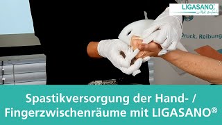 Spastikversorgung der Hand und Fingerzwischenräume mit LIGASANO® [upl. by Zednanref]