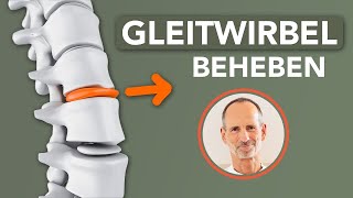 Was du bei Gleitwirbel tun kannst um dir selbst zu helfen gegen Rückenschmerzen [upl. by Sylvan]