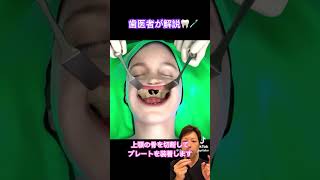 骨切り💀矯正治療 外科的矯正治療 上顎骨切り術 美容外科 審美歯科 出っ歯 ダウンタイム 口腔外科 外科手術 顎変形症 歯医者 プレート固定 [upl. by Annas]