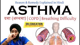 Cure Asthma दमा अस्थमा COPD  Breathing Difficulty  Cough in Hindi DrEDUCATION [upl. by Toshiko677]