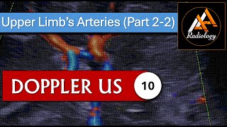 10  Upper Limbs Arteries Part 22 [upl. by Erund592]