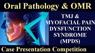 TMJ amp MYOFASCIAL PAIN DYSFUNCTION SYNDROME MPDS tmjdisorder [upl. by Anitsirk]