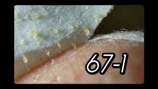 MOST EXCLLENT PORESTRIP 671 FEATURING NOSE 15 [upl. by Drhcir780]