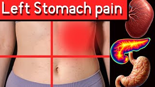 Top 7 Causes of Left Upper Abdominal Pain Left Upper Quadrant Pain [upl. by Dael111]