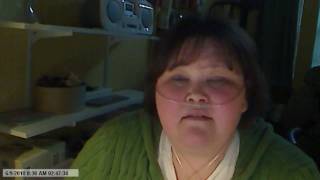 Lupus 6910 My Story Part 7 Finally the correct diagnosis [upl. by Sidoma]