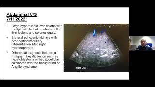 Alagille syndrome and genetic diagnosis of cholestasis in infants  Dr E Elkhatiali [upl. by Solomon737]