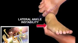 How to Tell if a Knee Injury is Serious  Yale Medicine Explains [upl. by Eniarrol995]