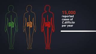 Faecal Microbiota Transplants FMT for treatment of serious infection [upl. by Rramel]