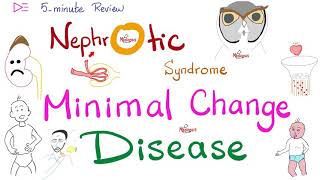 Minimal Change Disease  Nephrotic Syndrome  🖐 5Minute Review [upl. by Essenaj215]