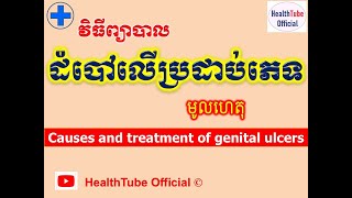 ដំបៅលើប្រដាប់ភេទ មូលហេតុនិងវិធីព្យាបាល l Genital ulcers l ជំងឺកាមរោគ l HealthTube Official [upl. by Jodi]