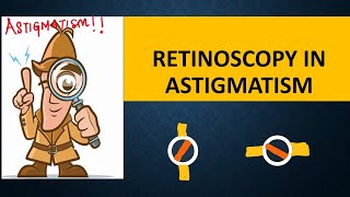 RETINOSCOPY in ASTIGMATISM  Break intensity  brightness and skew  Straddling [upl. by Edras383]