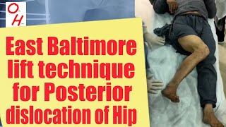 How to reduce a Hip dislocation or a dislocated Hip [upl. by Roseanna]