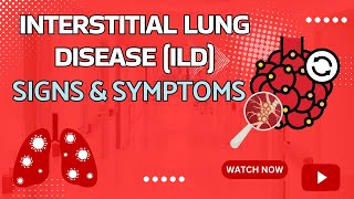 Interstitial Lung Disease Signs and Symptoms [upl. by Linsk]