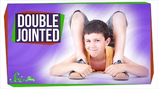 Why Are Some People DoubleJointed [upl. by Shulins]