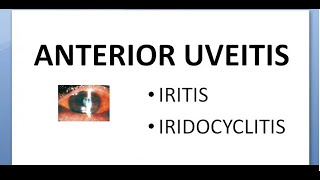 Ophthalmology 162 Anterior Uveitis Iritis IridoCyclitis Non suppurative glaucoma mechanism treatment [upl. by Ardeen686]