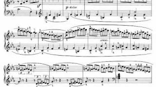 Beethoven Sonata quotPathetiquequot Op 13  III Rondo Allegro [upl. by Bastien]